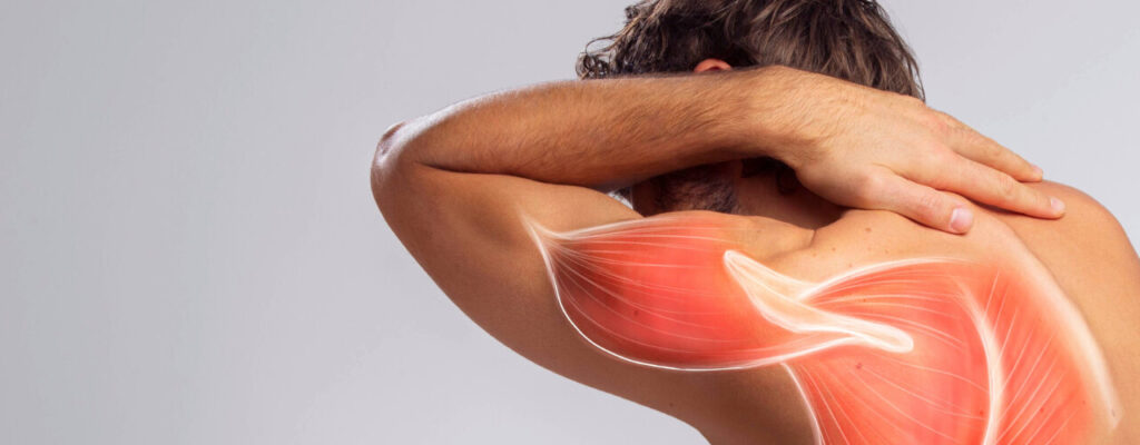 Shoulder Impingement: Causes, Symptoms, and Expert Guidance
